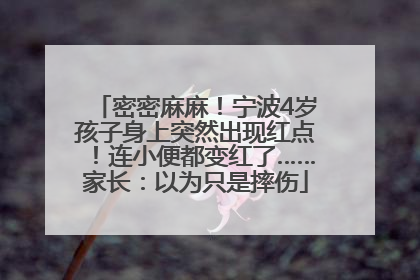 密密麻麻！宁波4岁孩子身上突然出现红点！连小便都变红了……家长：以为只是摔伤